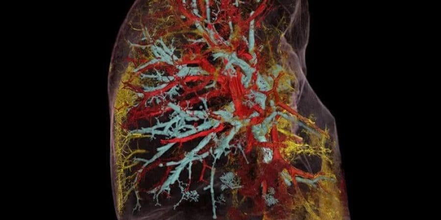 صورة بالتقنية الجديدة