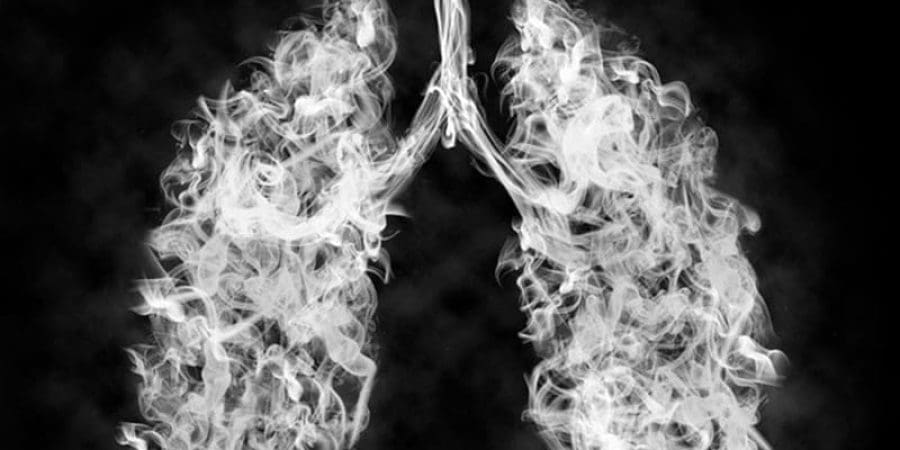 تعبيرية