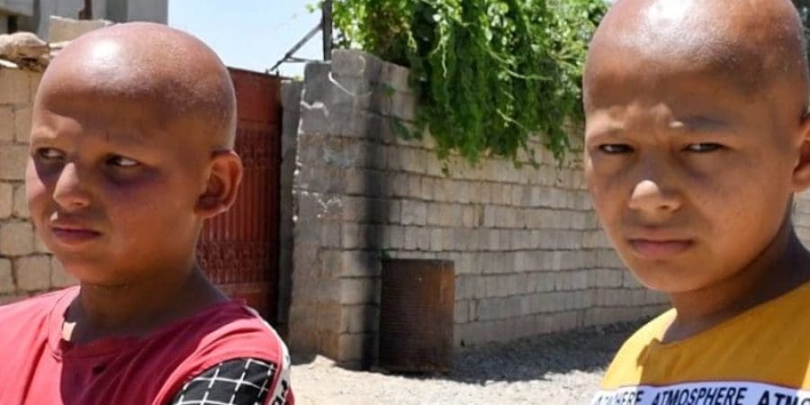 يرجح سكان محليون أن يكون تلوث مياه الشرب في القرية وراء ذلك