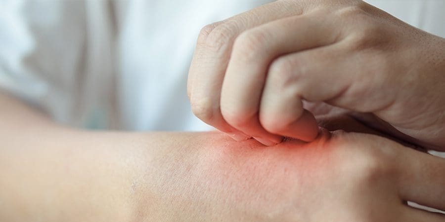 لا يجب إزالة القراد بهز المكان المصاب لئلا يقع الجسد وتبقى رأس القراد ملتصقة بالجسم