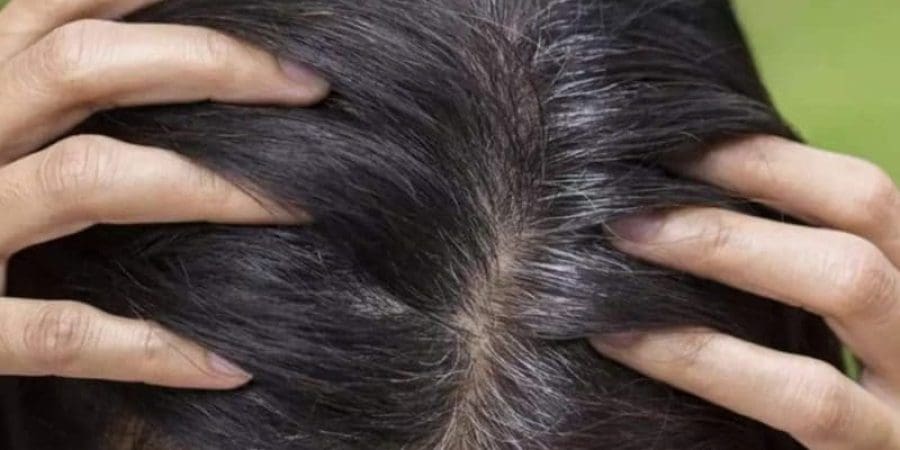تفسير جديد لظهور الشعر الأبيض