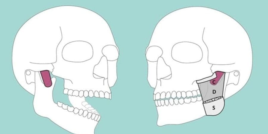 الطبقة العضلية العميقة الجديدة المكتشفة في عضلات الفك ضرورية للمضغ (جامعة بازل)