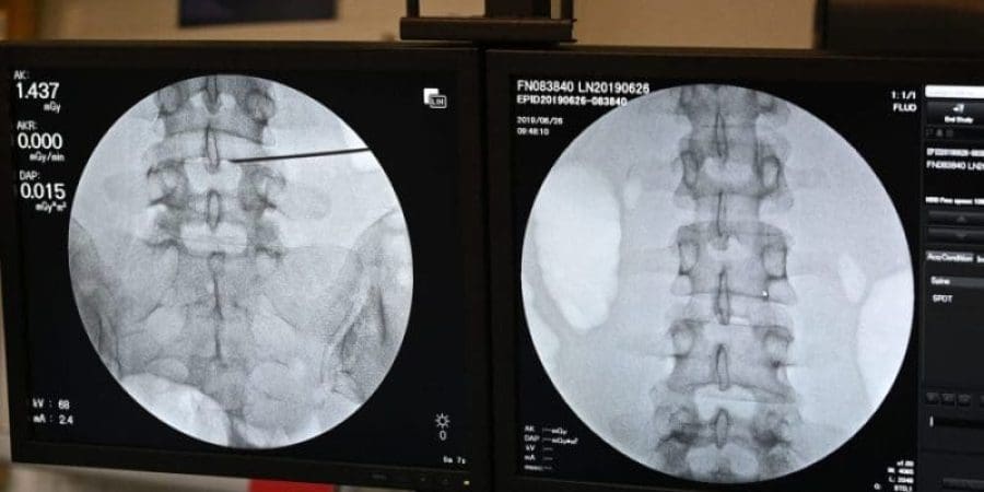 العمود الفقري
