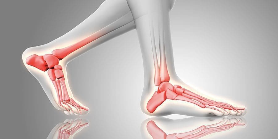 انتفاخ الساق