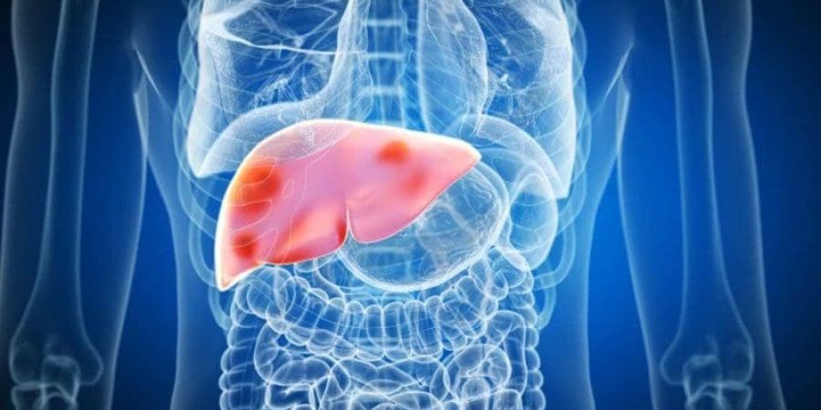 عندما يصاب الكبد بالالتهابات أو الإجهاد، تظهر الأعراض على الفور، ومن أكثرها شيوعًا الاستيقاظ في الليل والشعور بالامتلاء