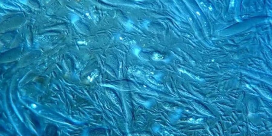 الوحيشات المجهرية كائنات وحيدة الخلية، من دونها لا يستطيع النمل الأبيض هضم السليلوز الذي يلتهمه