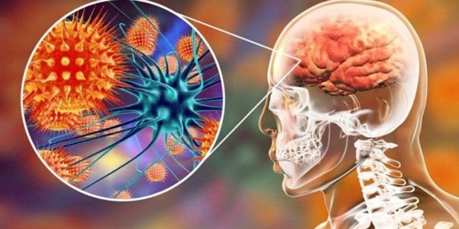 فيروس نيباه يصيب المخ بالتهابات مميتة خلال ساعات
