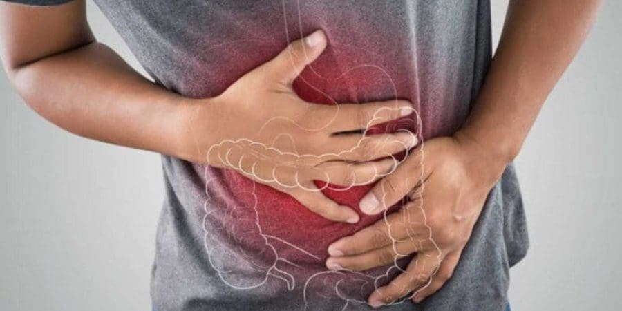 الاكتشاف المبكر عنصر مهم في التعامل مع سرطان القولون