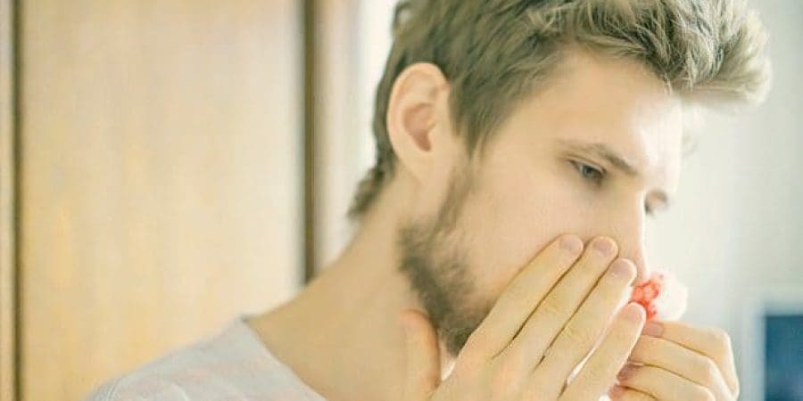 رعاف الأنف