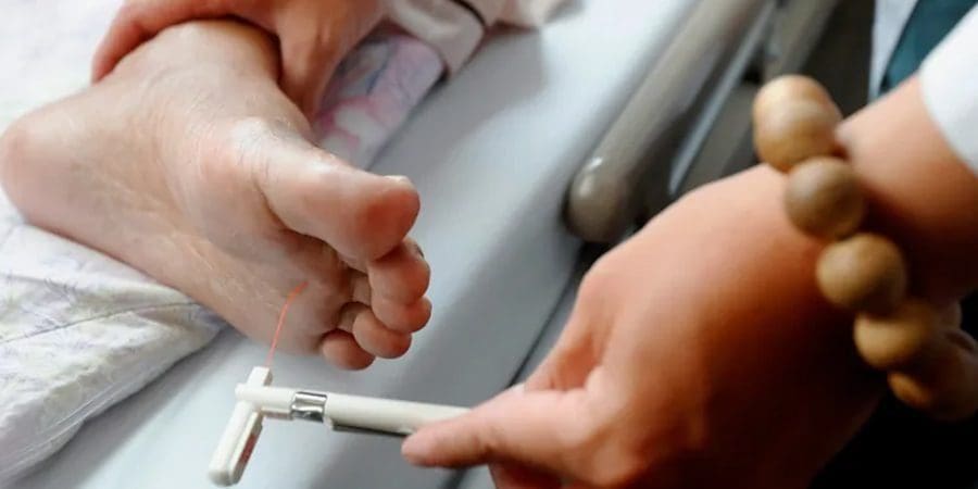 علاج مرضى اعتلال الأعصاب الطرفية يكون وفق المسبب للاعتلال، ومنها أدوية تخفف أعراض الوخز والخدران.