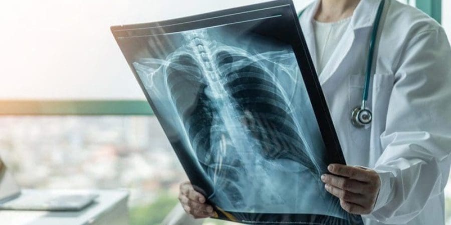 عادت أعداد الإصابات والوفيات بفيروس كورونا إلى الارتفاع في عدة دول، ويؤكد الخبراء أن المتحور دلتا سبب ذلك الارتفاع