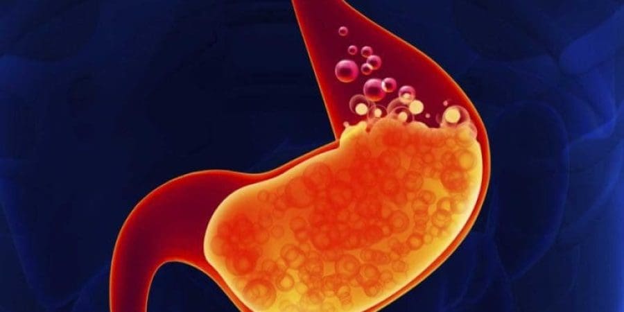 حموضة المعدة