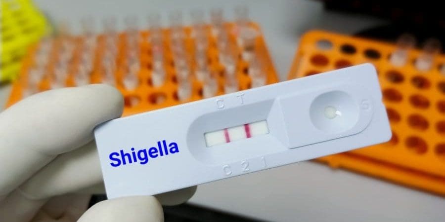 عدوى الشيغيلا