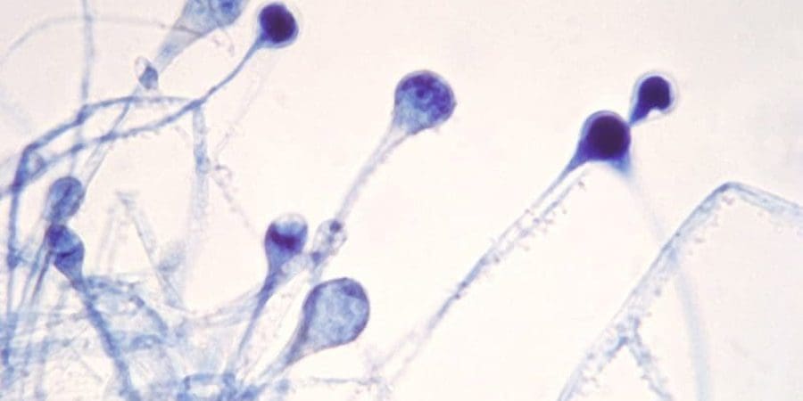 الفطر الأسود | تعبيرية