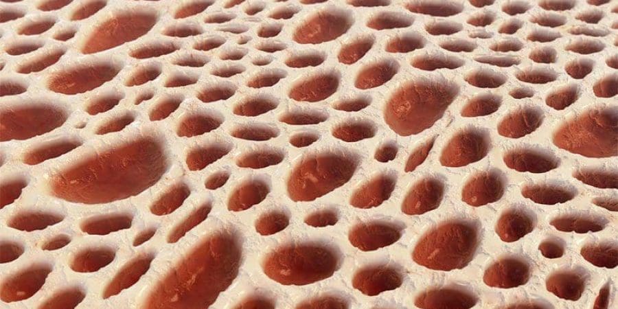 نقي العظام (iStock)