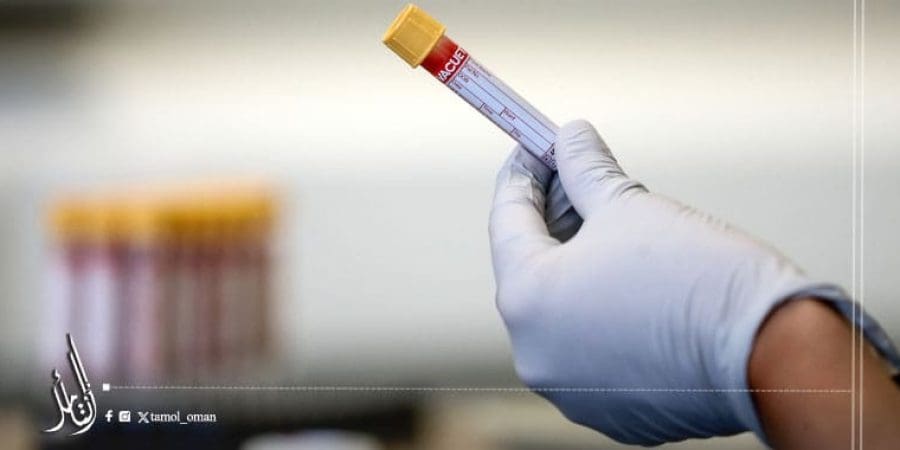 علماء ينجحون في تغيير فصيلة دم كلى لتتوافق مع فصيلة أخرى